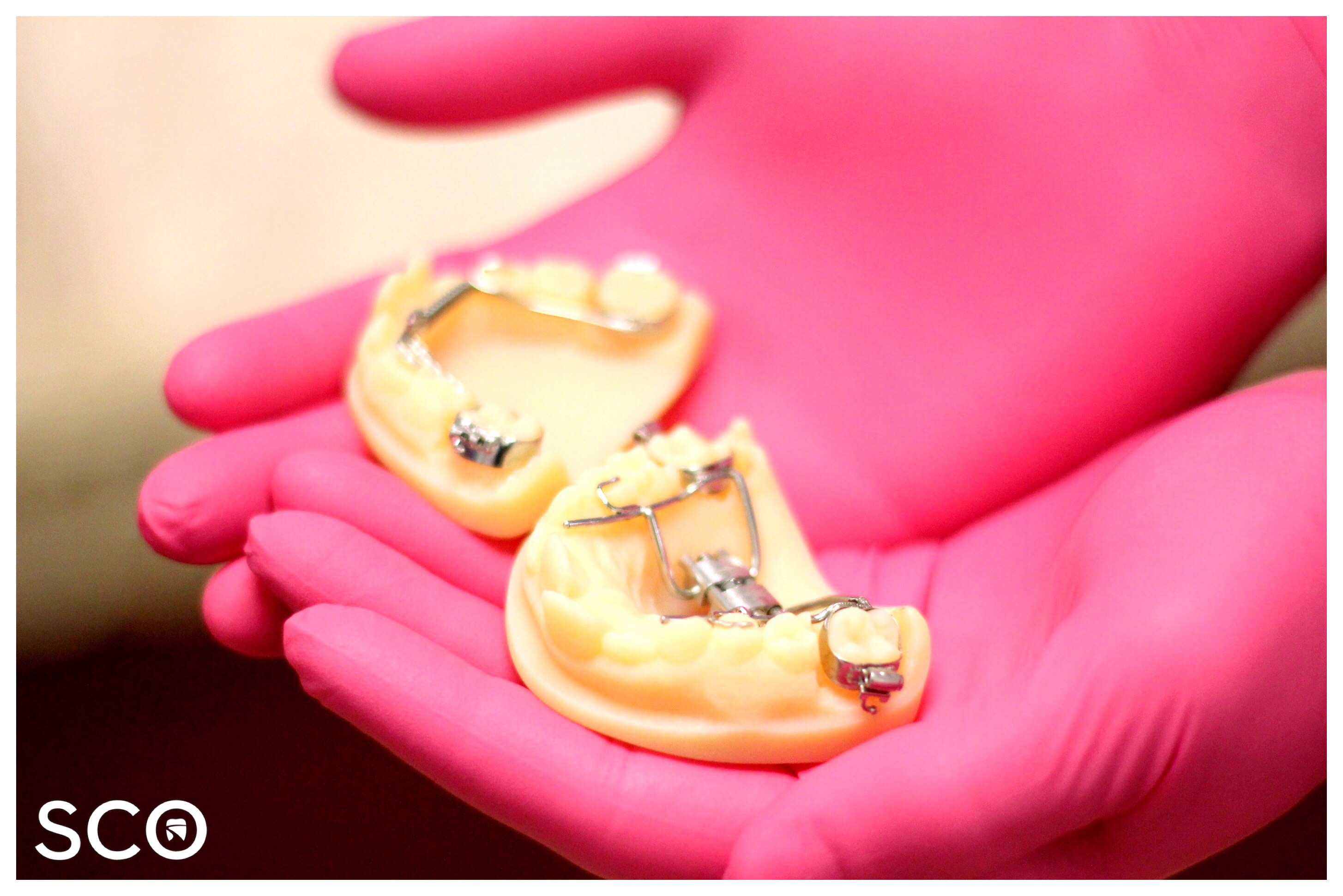 Saddle Creek Orthodontics | Digital Scanner Appliances | Orthodontic 3-D Printed Models