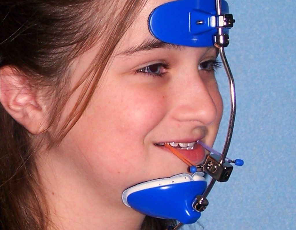 Are Orthodontic Headgear Braces Worth It? | vlr.eng.br