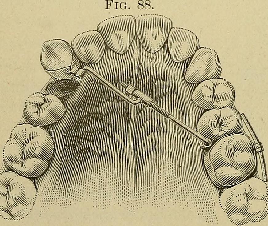 19th Century Orthodontic Diagram | Orthodontics