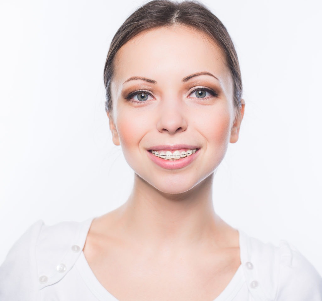 woman with clear braces