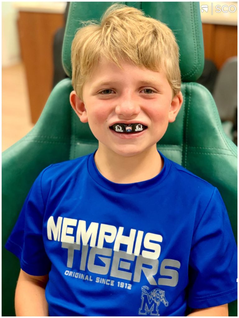 Braces And Mouthguards What You Need To Know Memphis Braces